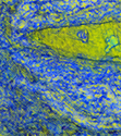 fishbone (thumbnail)