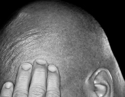 Headache (thumbnail)