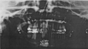 panorama%20x-ray (thumbnail)