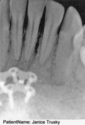 front%20lower%20%20x-ray (thumbnail)