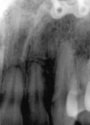 close%20up%20%20x-ray (thumbnail)
