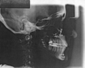 profile%20xray (thumbnail)