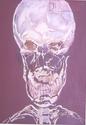 Elongated%20X-Ray (thumbnail)