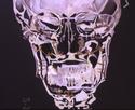 Frontal%20X-Ray (thumbnail)