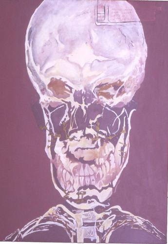Elongated%20X-Ray (large view)