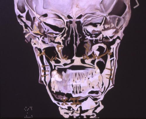 Frontal%20X-Ray (large view)