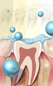 Illustration-Chewing Gum with Sodium Hexametaphosphate