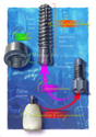 Illustration-Dental Implant System
