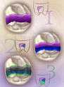 Illustration-Direct Resin-Based Composites
