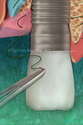 Illustration-Replacing a Fractured Upper Incisor with Implant Supported Crown
