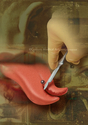 Illustration-Tongue Splitting