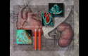 Illustration-Cardiovascular Disease and Renal Failure, Heart, Kidneys, Ultrasound, Blood Testing, EKG