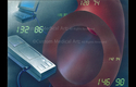 Illustration-Blood Pressure Monitoring, High Blood Pressure, Blood Pressure Cuff, Vessel, Vein