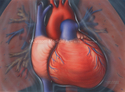 Illustration-Congestive Heart Failure, Heart, Pulmonary Edema, Lungs, Fluid Build Up