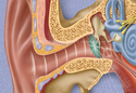 Illustration-Hearing Loss, Cross Section of Inner Ear, Sound Waves, Ear Drum