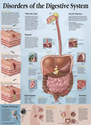 Disorders of the Digestive System Patient Education Poster