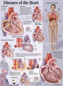 Illustration-Diseases of the Heart Patient Education Poster