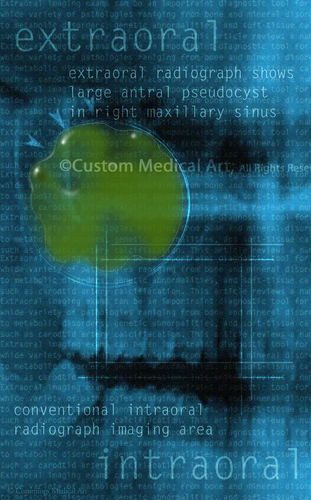 Illustration-Intraoral & Extraoral Dental Radiographs