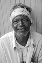 Photography-Man With Bandage