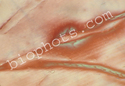 Acetimide Crystal 100x