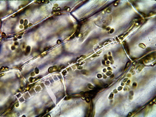 Onion skin cells with chloroplasts