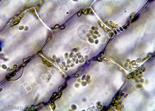 Onion Skin cells at 400X