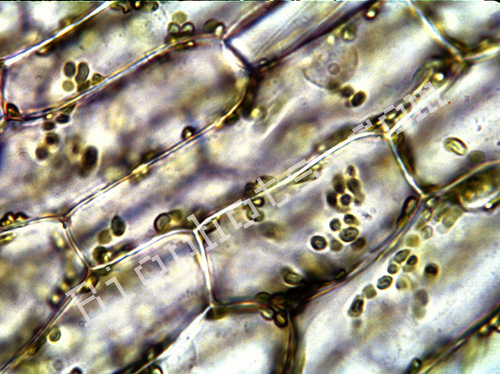 Onion Skin cells
