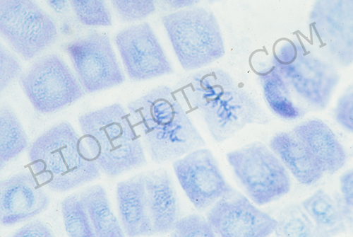 Metaphase cells