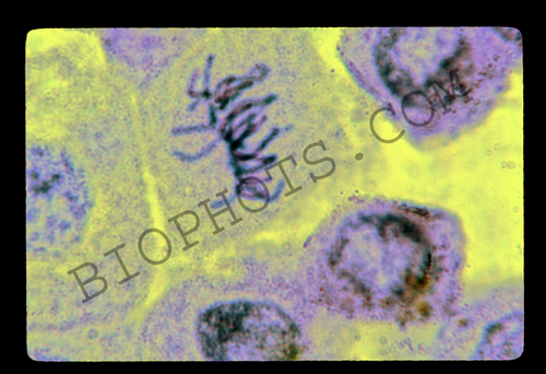 Metaphase cell