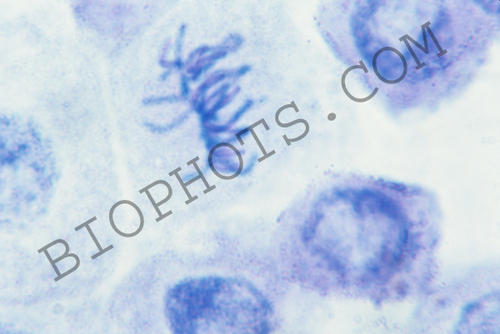 Metaphase