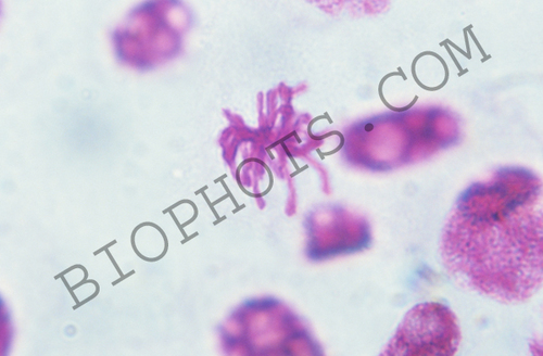 Metaphase