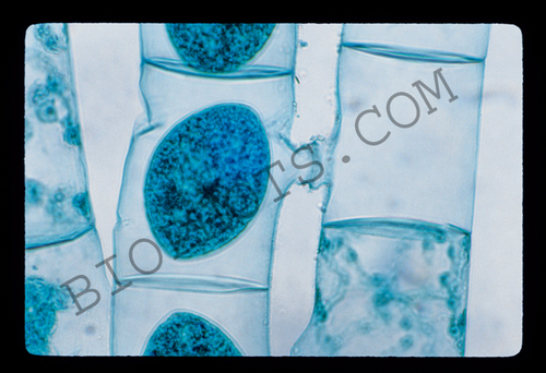Spirogyra conjugation
