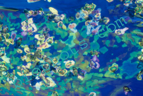 Acetemide photomicrograph
