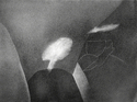 Gateway Gateway (thumbnail)